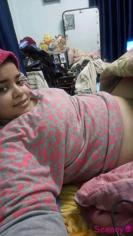 AcOnnA3b